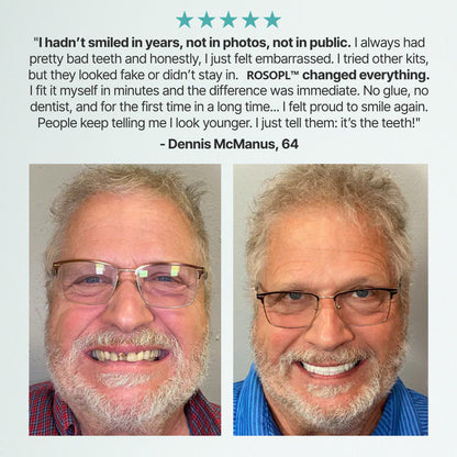 🔥 Don't Miss Out! 70% OFF ROSOPLTM Custom Dentures for a Perfect, Confident Smile!
