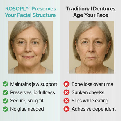 🔥 Don't Miss Out! 70% OFF ROSOPLTM Custom Dentures for a Perfect, Confident Smile!