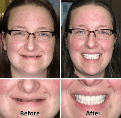✨Health America Subsidized Product✅LAOZIKTM-Advanced Custom