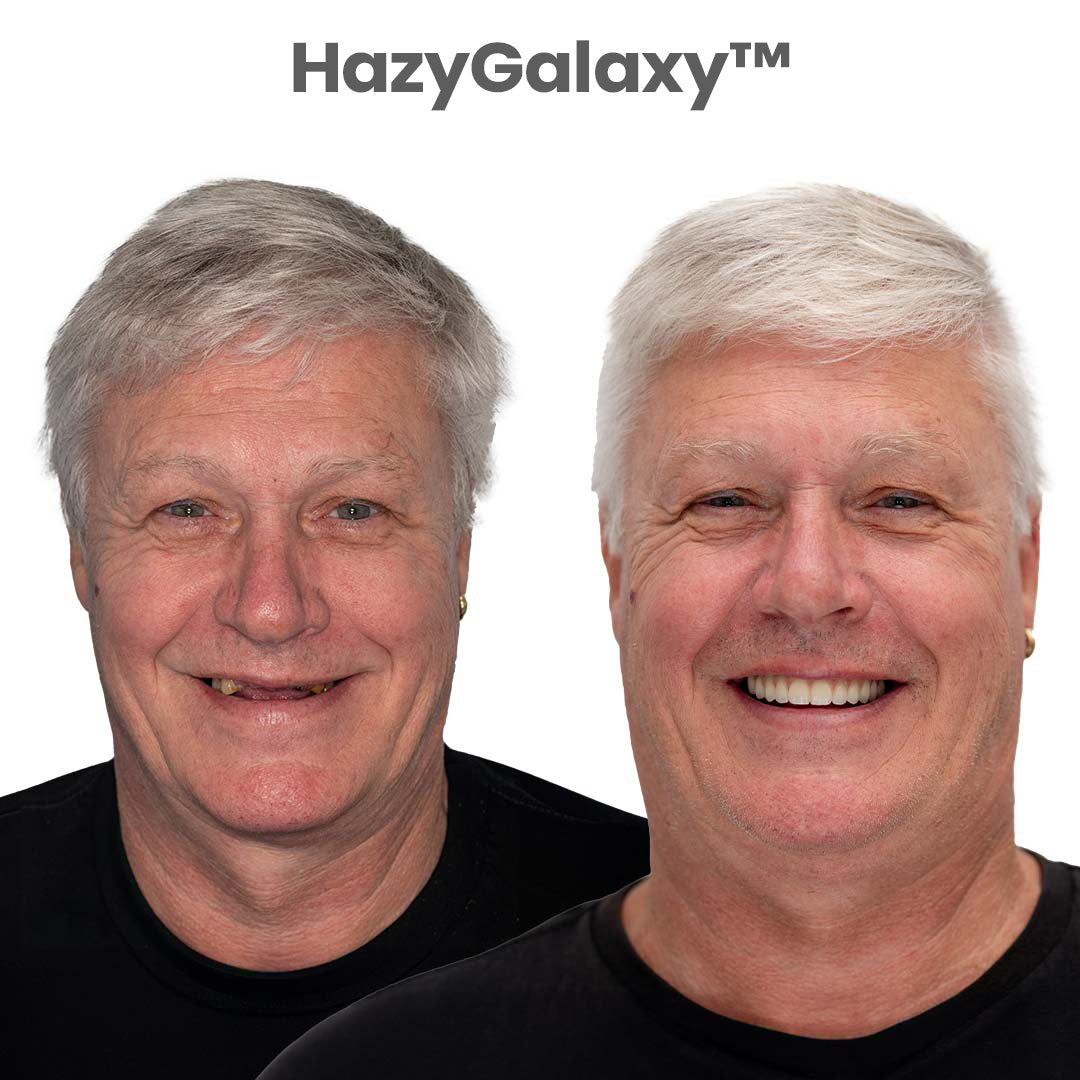✨🦷 HazyGalaxy™ Custom-Fit Dentures ⏰ ENDS TODAY   70% OFF | Smile with Confidence