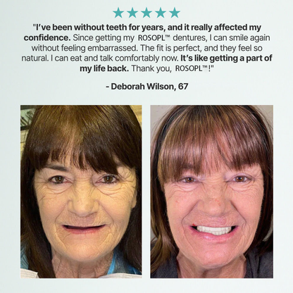 🔥 Don't Miss Out! 70% OFF ROSOPLTM Custom Dentures for a Perfect, Confident Smile!